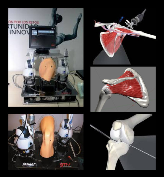 Endoscopy Simulator